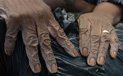 A woman's hands are wrinkled from wading in the flood water